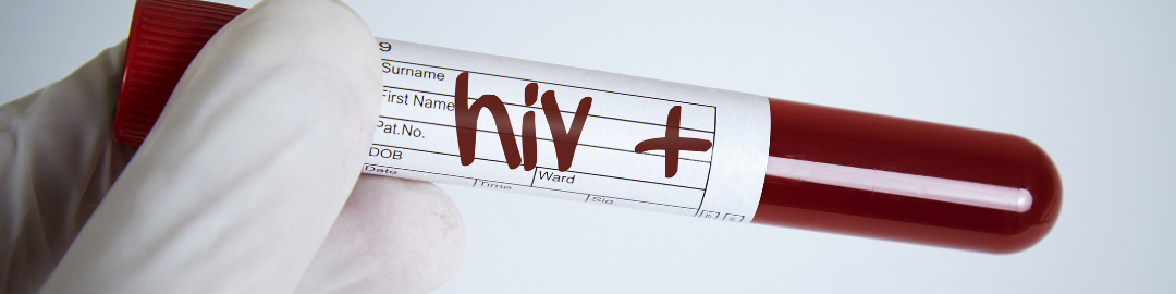HIV