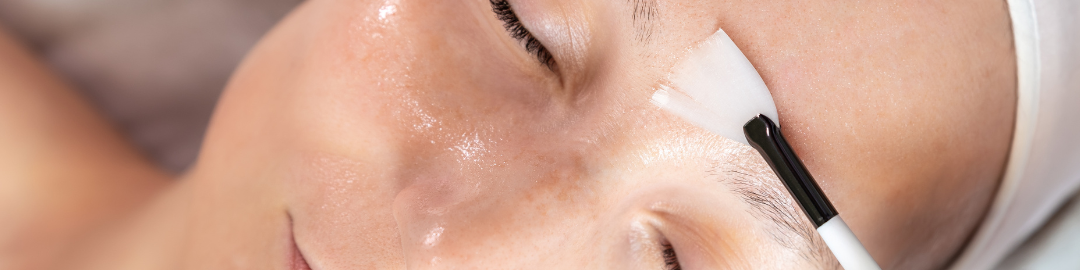peeling de fenol 